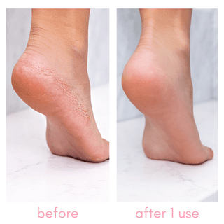 Kiara Sky Heeling Callus Remover 8oz - C8 Nail SupplyKiara Sky